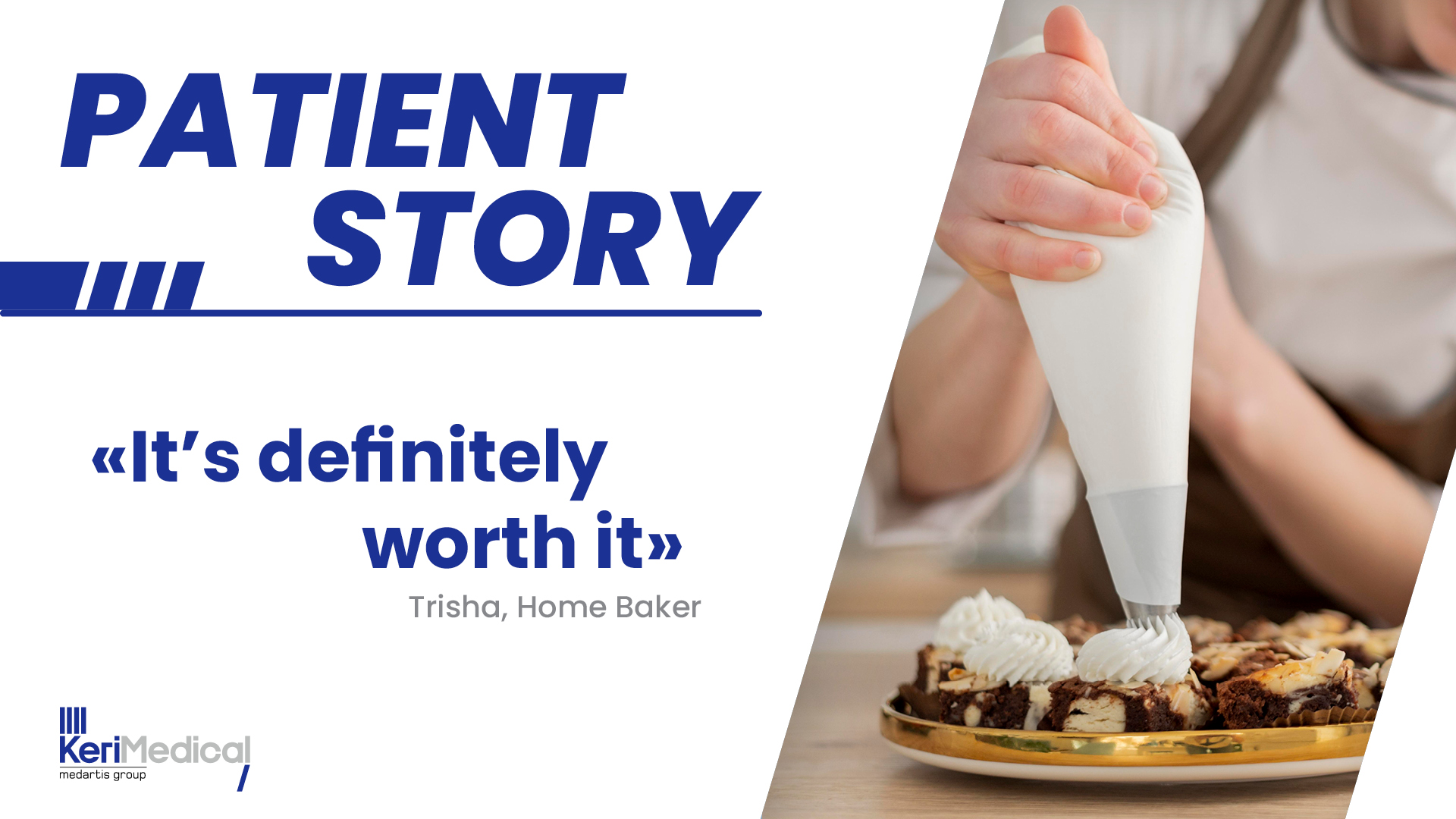 First U.S. TOUCH® Patient Chooses a Second Thumb Joint Replacement